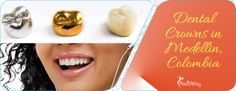 Dental Crowns in Medellin, Colombia Dental Crowns in Medellin, Colombia